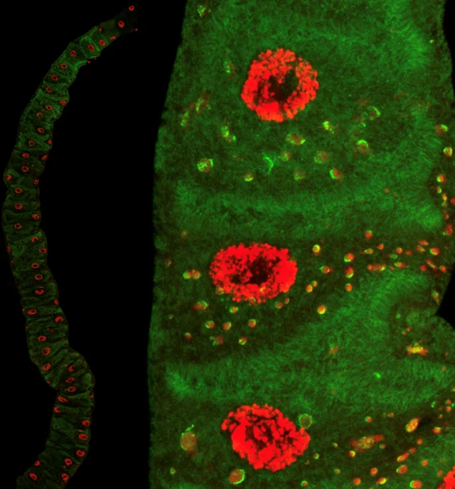 Confocal images of the kidney-like Malpighian tubule from a Drosophila larva 