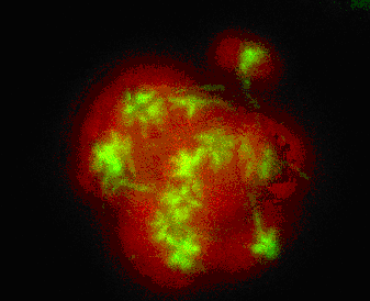 Eine mit BAL27862 behandelte mitotische Tumorzelle (Grün: Mikrotubuli. Rot: DNS)