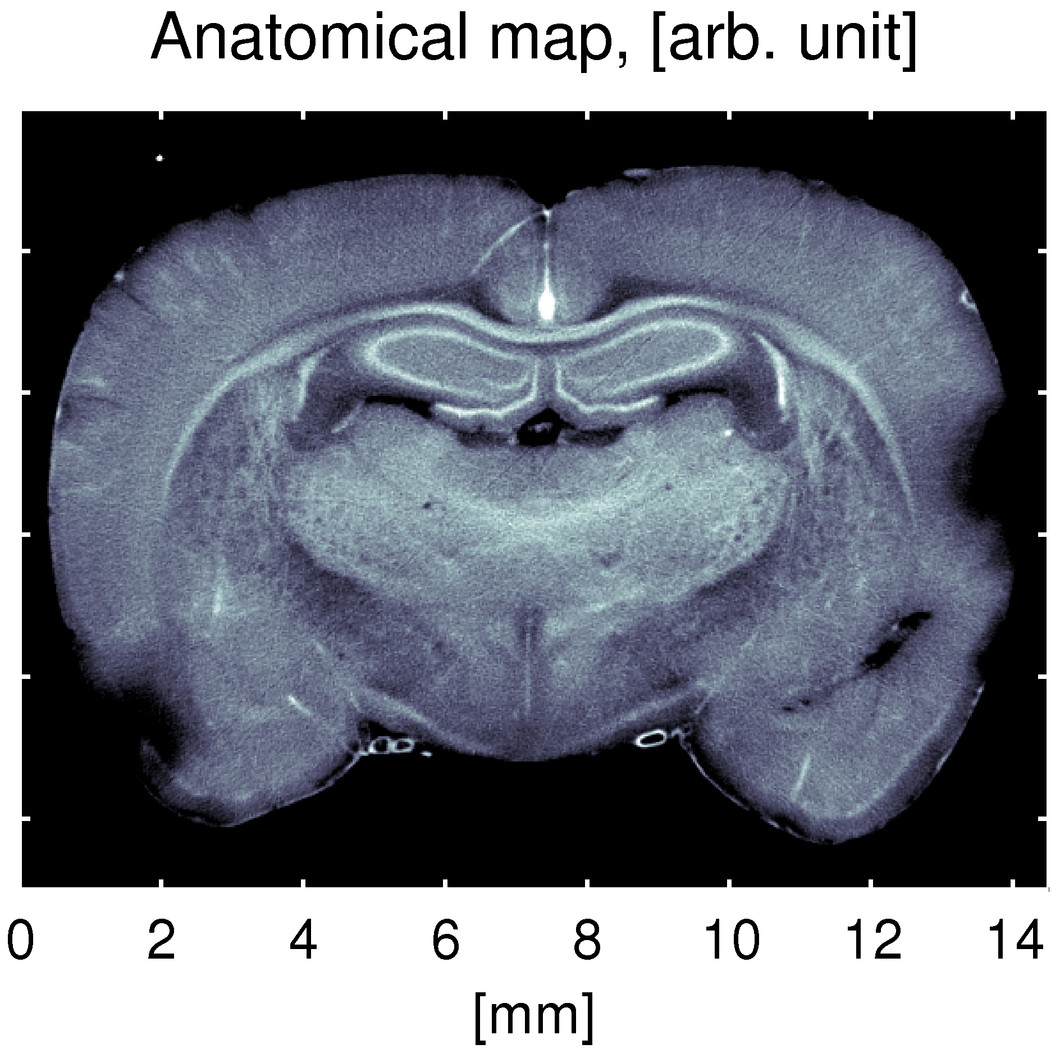 These three images show the same cross-section of the brain of a rat, all obtained using the new process. 
a) This image shows the results of scanning Small-Angle X-ray Scattering, which can be used as an anatomical map of the rat’s brain. (Image: Niels Bohr Institute, Copenhagen)
