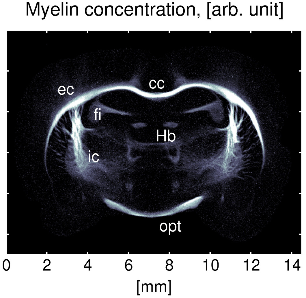 b) The myelin concentration in the rat’s brain is seen here, with the highest concentration occurring around the corpus callosum (the bundle of nerve fibres connecting the two hemispheres of the brain) and at the internal and external capsules. The myelin concentration could be determined without having to dissect the brain. (Image: Niels Bohr Institute, Copenhagen)