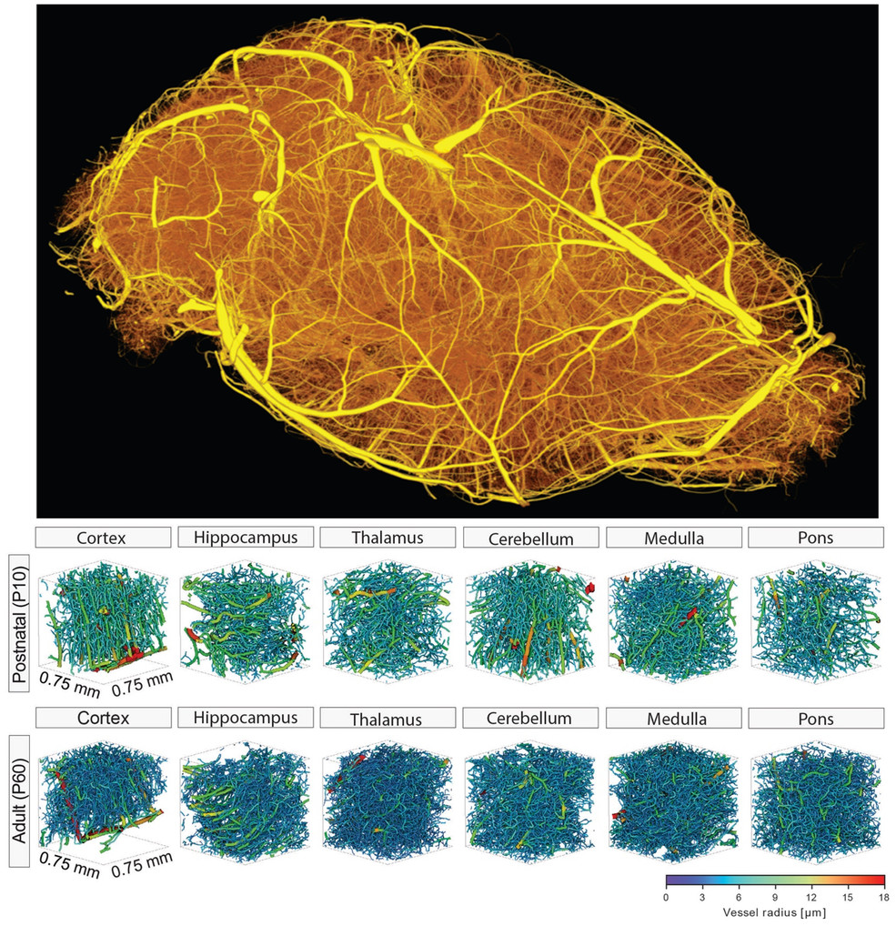 3D reconstruction of a high-resolution synchrotron-based tomographic microscopy scan of an entire adult mouse brain vasculature