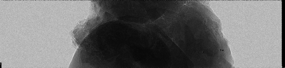 kidney stone: high resolution digital image (with interpolation)