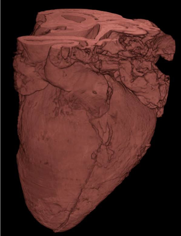 3D rendering of a human fetal heart (15 weeks) acquired with X-ray tomography at 20 keV.