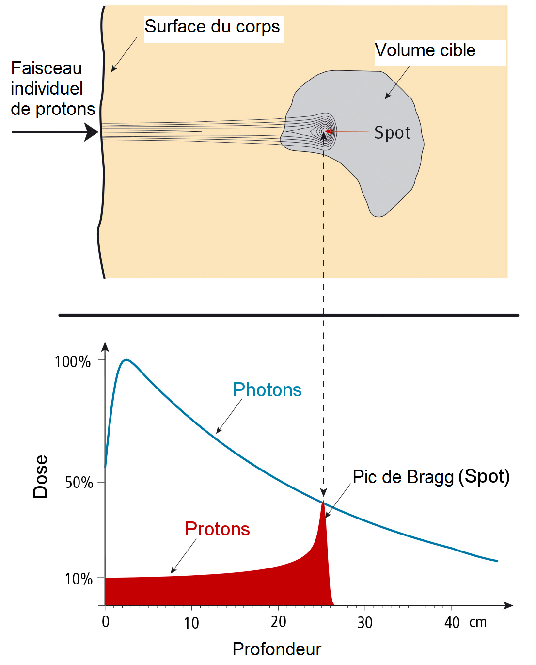 Dose de radiation d’un faisceau-crayon en fonction de sa pénétration dans l’organisme. La portée de ces protons est de 25 centimètres. En haut, la répartition de la dose sous forme de courbes de niveaux. En bas, les valeurs de la dose en fonction de la profondeur, comparées avec l’évolution d’une dose de photons.