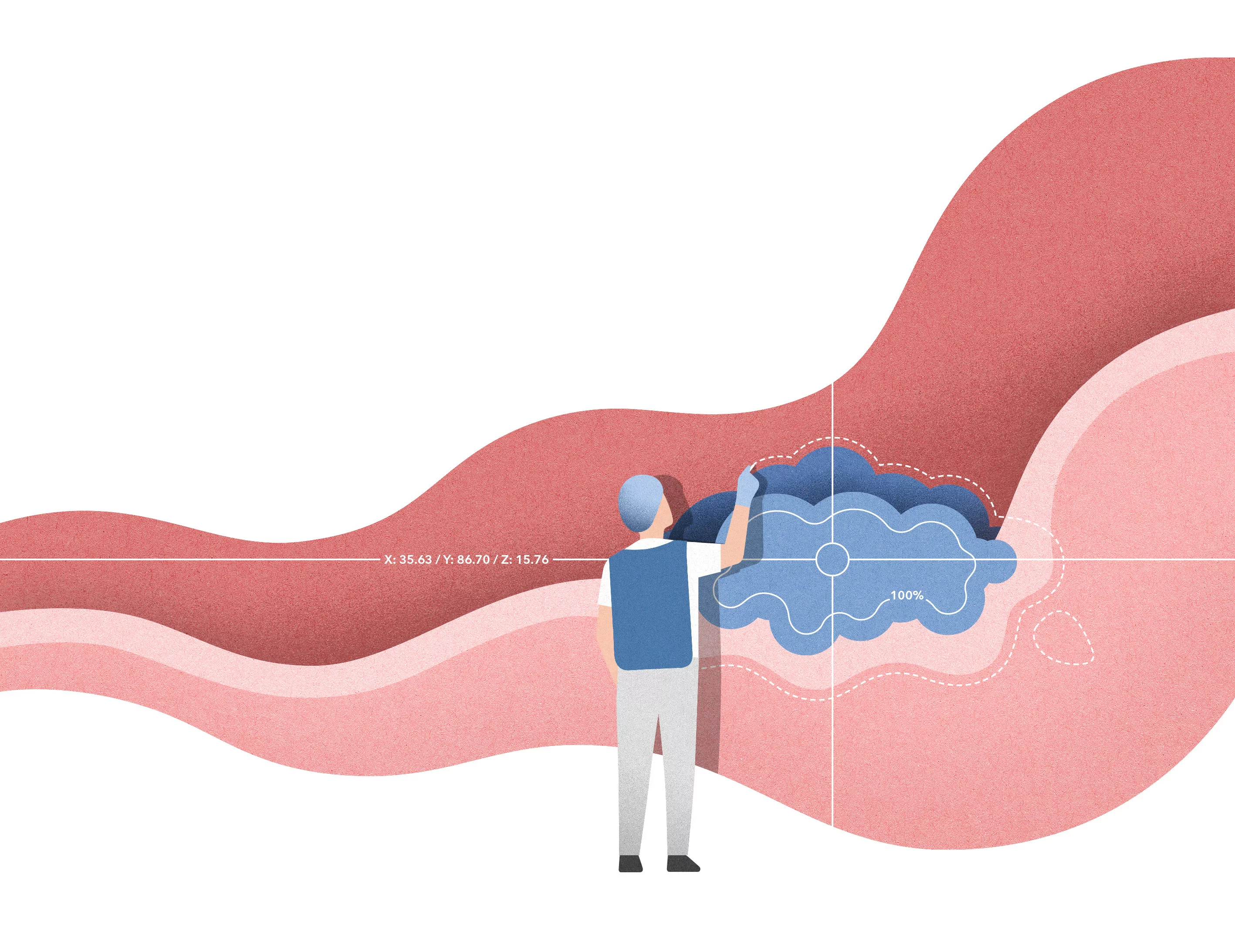 Krebszellen unter Beschuss