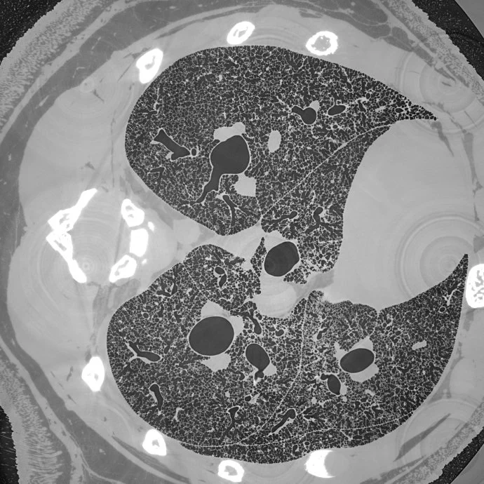 Micrometer-resolution X-ray tomographic imaging of a complete intact post mortem juvenile rat lung 