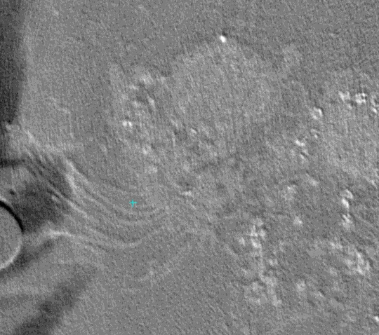human_ciliated_bronchial_epithelial_cell