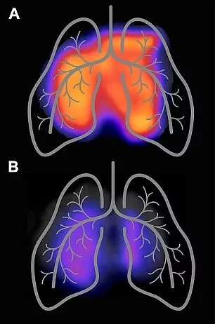 PET Images of lungs