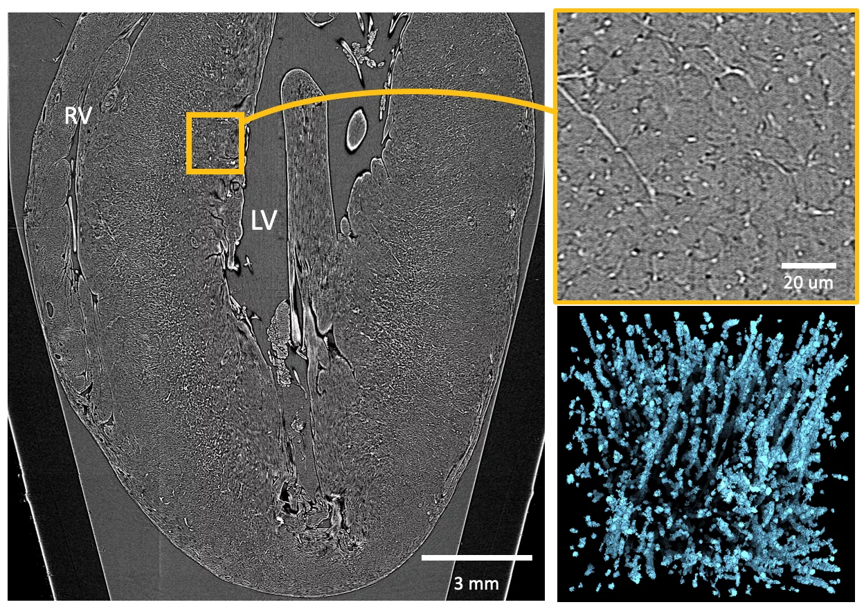 Multiscale image of a cardiac tissue.