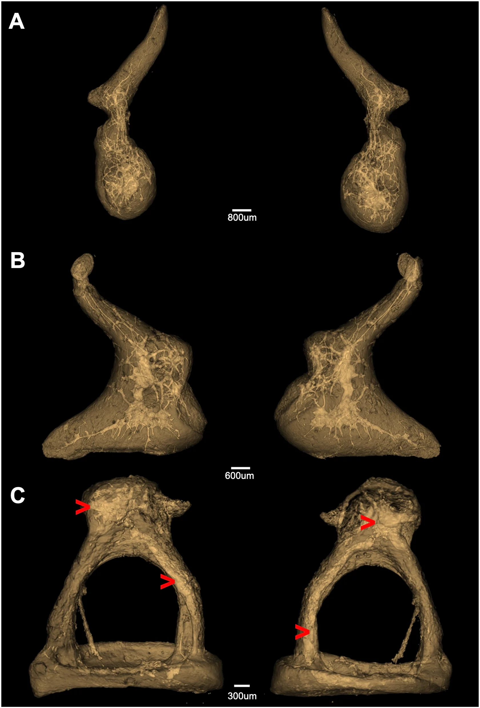 nutritional vessels of a right ossicular chain