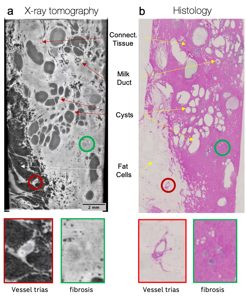 JOan Maxim improved pathology