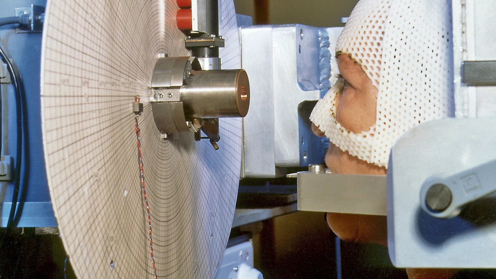 Die PSI-Protonentherapie für Augentumoren (OPTIS).