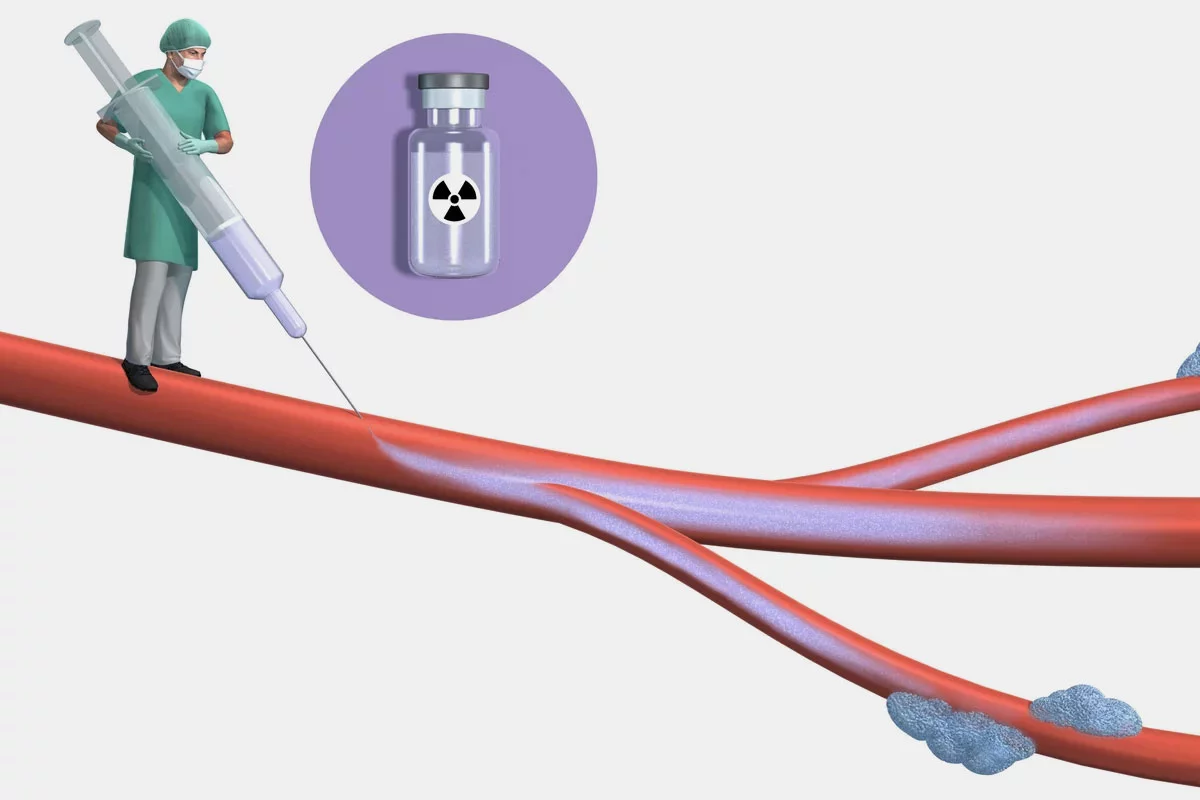 Die Herstellung und Anwendung von Radiopharmaka für die Diagnose und Therapie von Tumoren ist ein Focus bei der Zusammenarbeit zwischen KSB und PSI. 