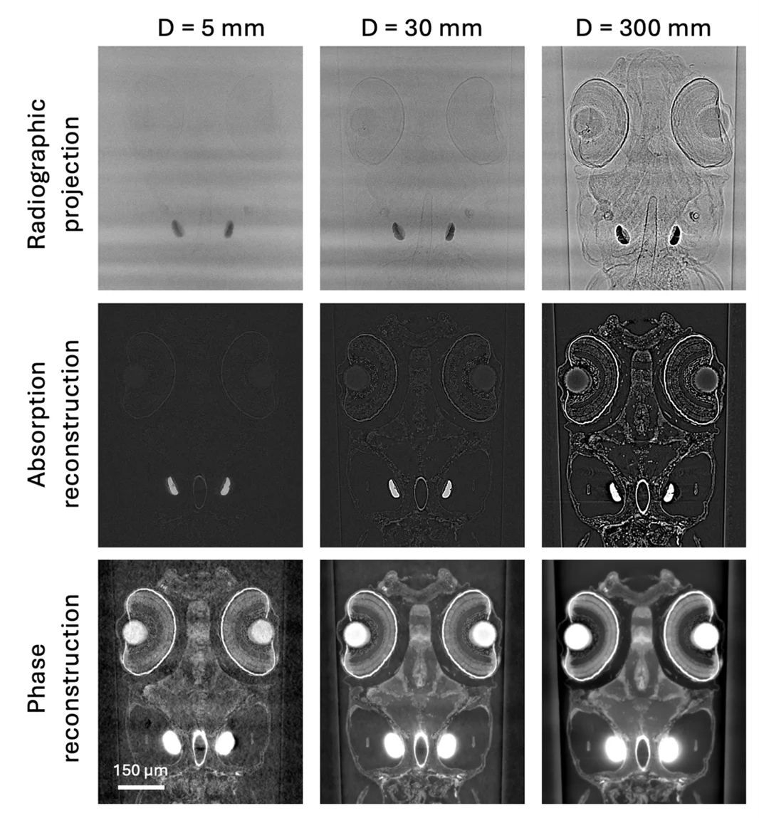 propagation-based phase contrast