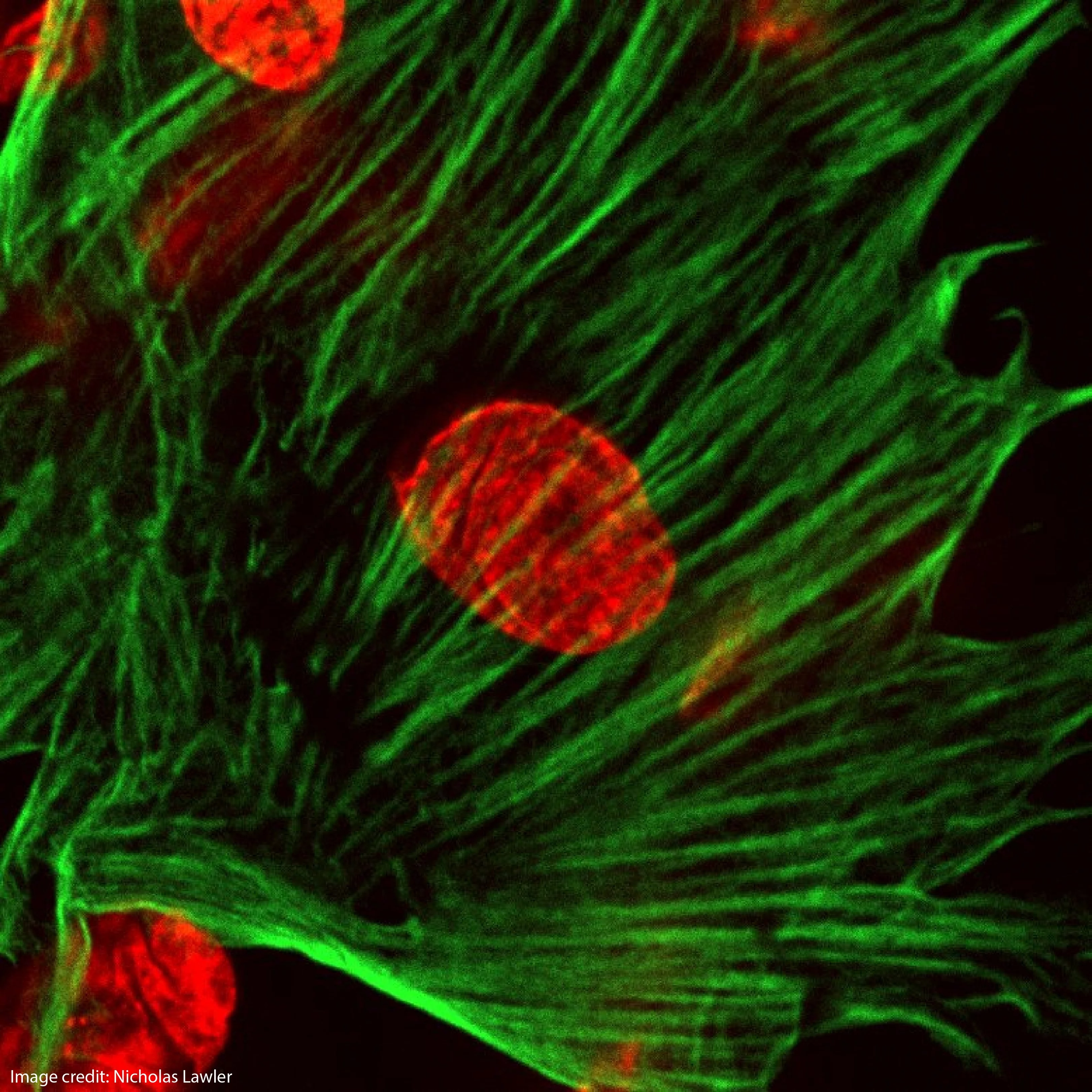 Roter Zellkern, grünes Zellskelett: In mikroskopischen Aufnahmen wie dieser erkennt die am PSI entwickelte KI feinste Veränderungen im Chromatin – und damit genetische Störungen. 
