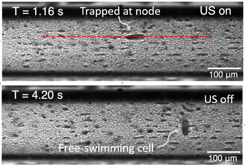 Fig.3 (top) A motile Tetrahymena cell is captured along one of the node lines by ultrasound (US), (bottom) that could freely swim in the fluidic channel when the US is turned off. 