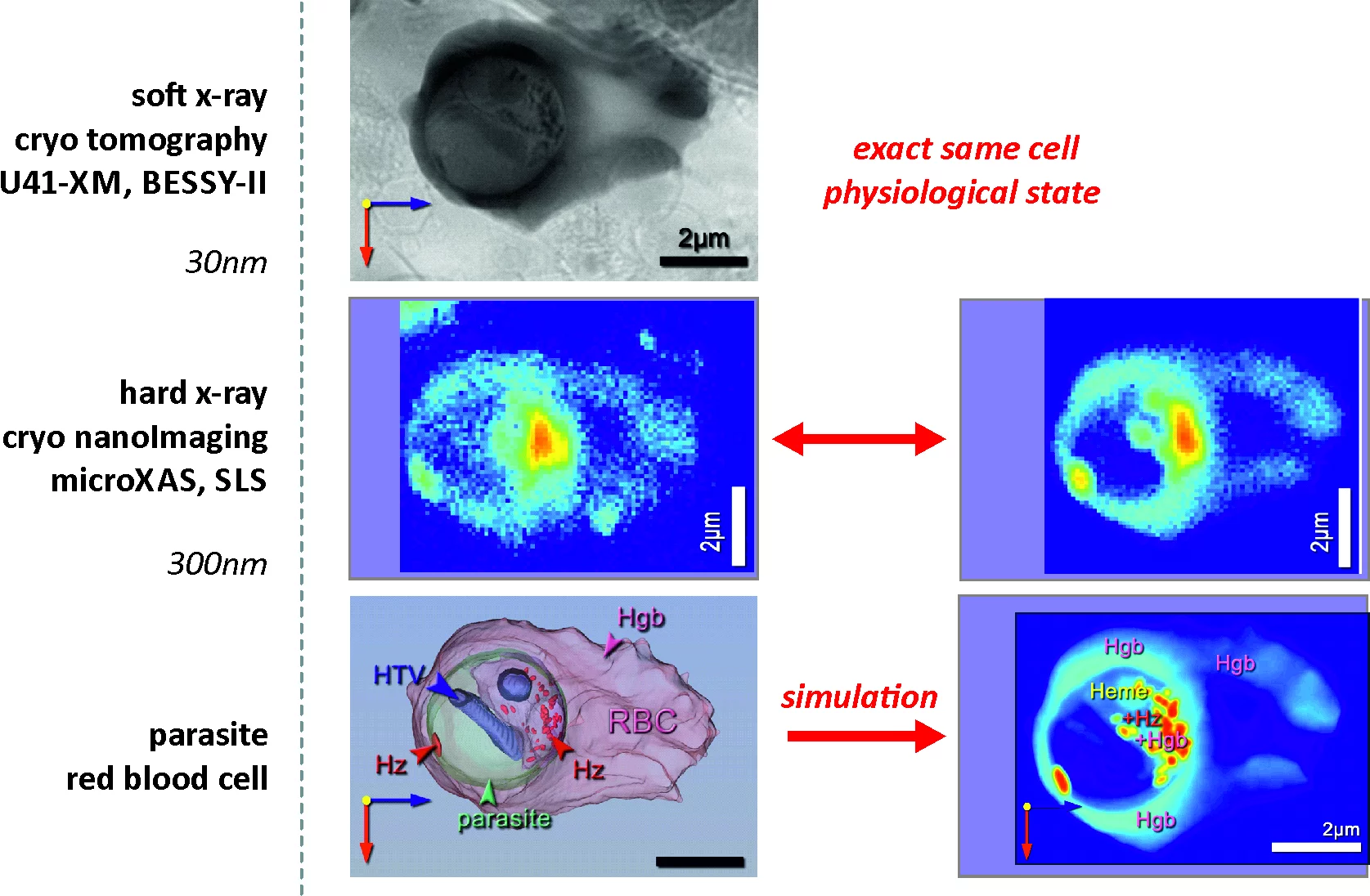 Unique insights in the adolescence and metabolism of Malaria parasite in human red blood cells are obtained by a new chemical imaging methodology – _in situ_ correlative X-ray fluorescence microscopy and soft X-ray tomography e and discharge.
