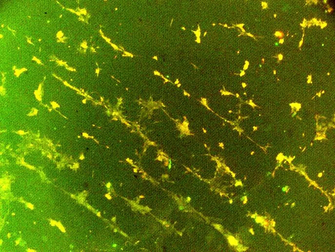 Alignment of PAE cells cultured on a pattern of VEGF