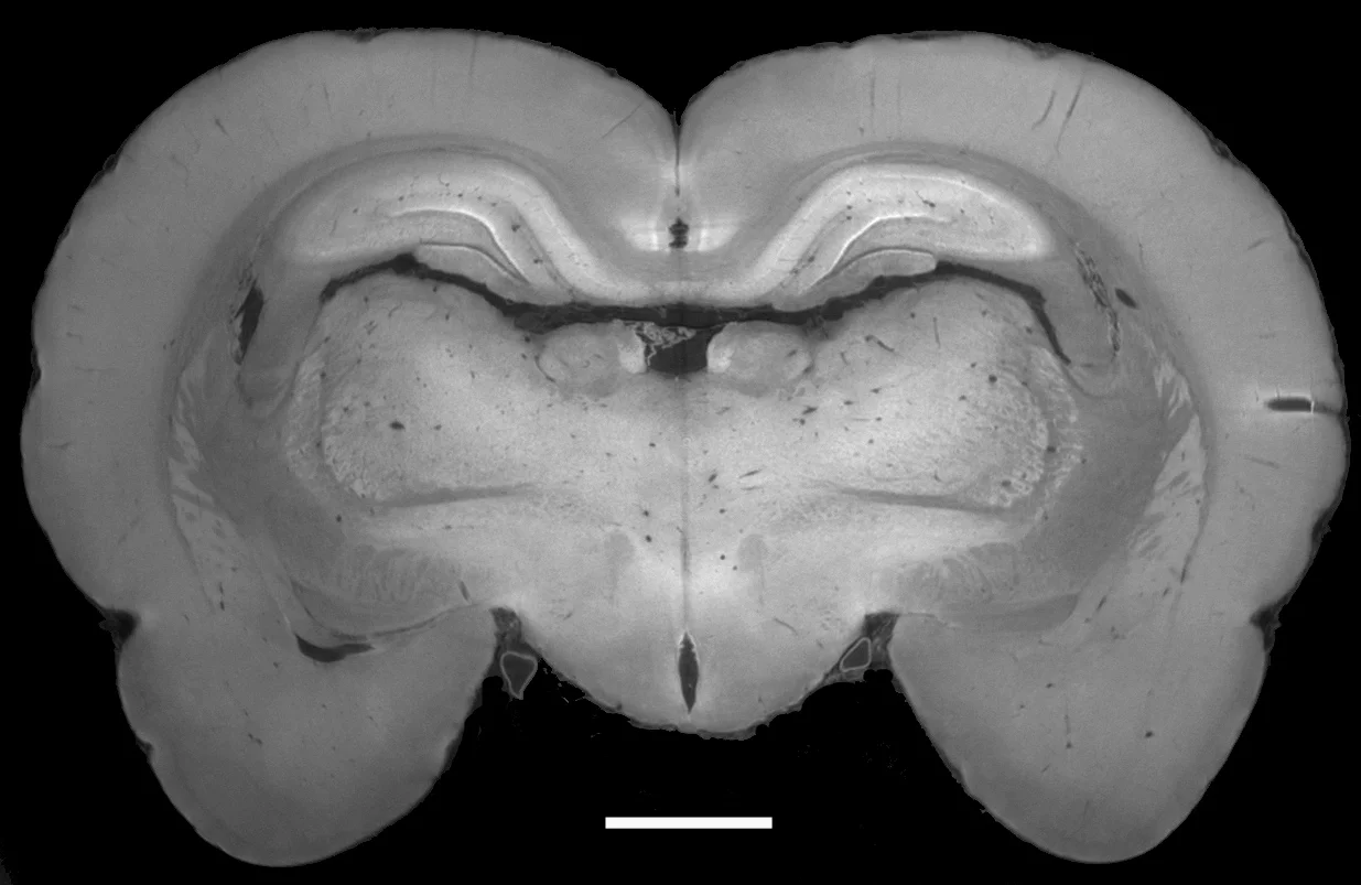 Abbildung eines Rattenhirns. Das Bild wurde in der Arbeitsgruppe von Marco Stampanoni am Paul Scherrer Institut mit der weiterentwickelten Phasenkontrastmethode erzeugt. Die wesentlichen anatomischen Strukturen sind deutlich sichtbar. Die weisse Linie entspricht einem Millimeter, es sind Details von etwa 10 tausendstel Millimeter sichtbar. (PSI)