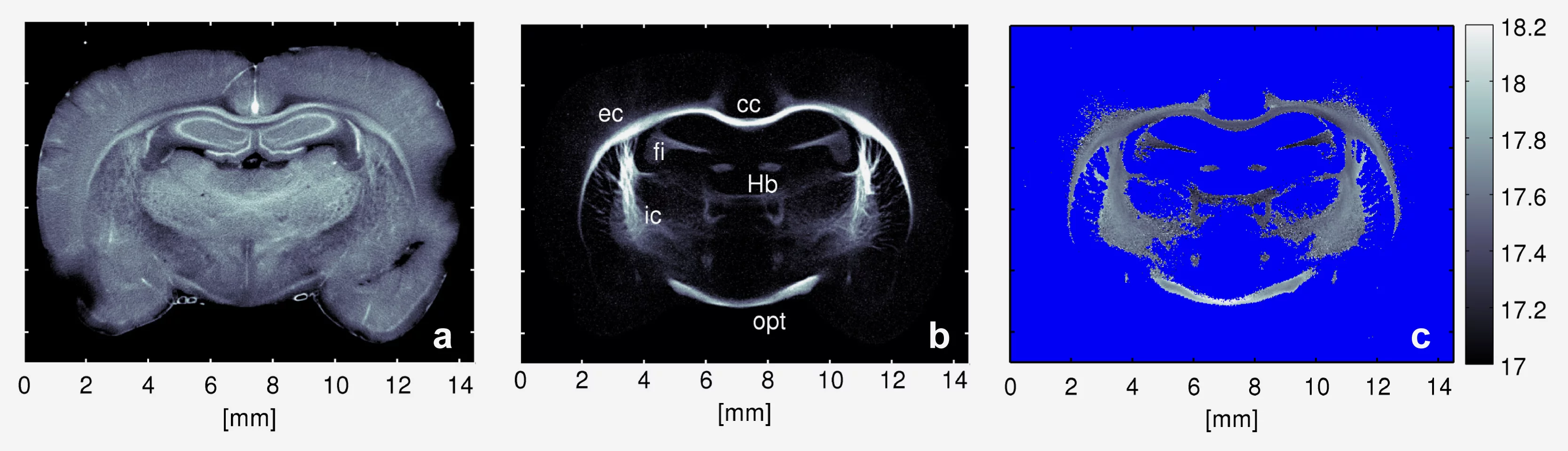 These three images show the same cross-section of the brain of a rat, all obtained using the new process. (Images: Niels Bohr Institute, Copenhagen)
a) This image shows the results of scanning Small-Angle X-ray Scattering, which can be used as an anatomical map of the rat’s brain. 
b) The myelin concentration in the rat’s brain is seen here, with the highest concentration occurring around the corpus callosum (the bundle of nerve fibres connecting the two hemispheres of the brain) and at the internal and ex…