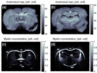 cross-section of the brain of a rat