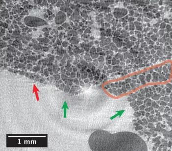 In vivo tomographic slice of a newborn rat’s lung with alveolar resolution.