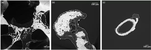Tomographic slices of: (a) ROI in the cochlea, (b) incus and (c) stapes. Images acquired at the TOMCAT beamline, PSI Switzerland.