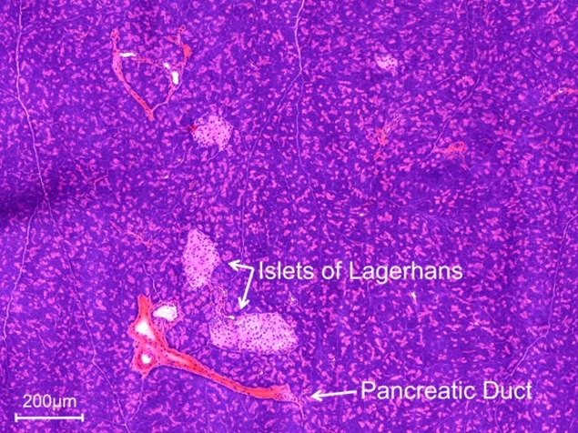 HE pancreas.jpg