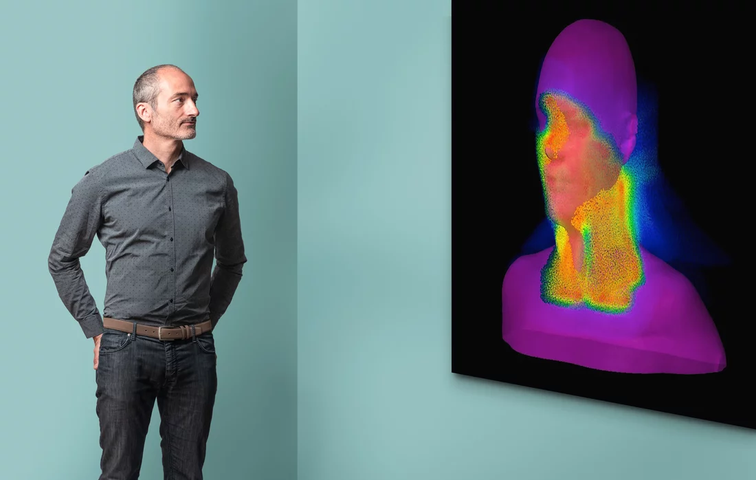 Nicola Bizzocchi, specialista in dosimetria, pianifica la terapia individuale per ciascun paziente, dividendo il tumore in diverse sezioni con l'aiuto di un programma informatico specifico. 