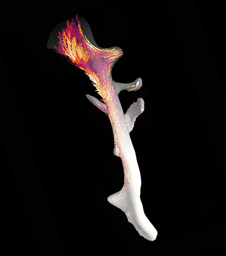 The bone and its nanostructure: Using their technique, Liebi, Guizar-Sicairos and colleagues could map the order and alignment of collagen fibres in this 2.5mm trabecular bone. 