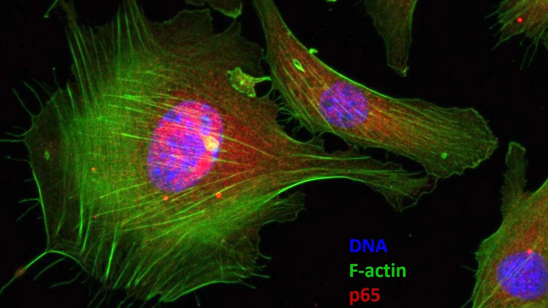 Immunostained HMF3a Cells