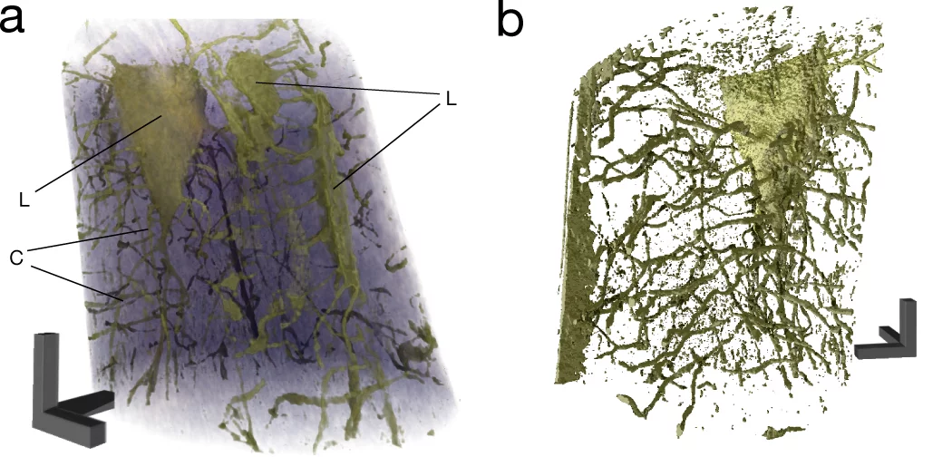 Aus vielen Röntgenstreubildern (links angedeutet) berechnet der speziell entwickelte Nano-CT-Algorithmus ein hochaufgelöstes dreidimensionales Nanotomogramm der Probe. In der Knochenforschung angewendet, macht das Verfahren die feinen, ca. 100 Nanometer grossen Verästelungen (Canaliculi) zwischen den Knochenzellen (Osteocyten) sichtbar.Copyright: M. Dierolf, P. Thibault, F. Pfeiffer / TU München Nutzungsrecht: Verwendung für Journalisten frei im Zusammenhang mit der Pressemitteilung vom 23.09.2010 und unte…