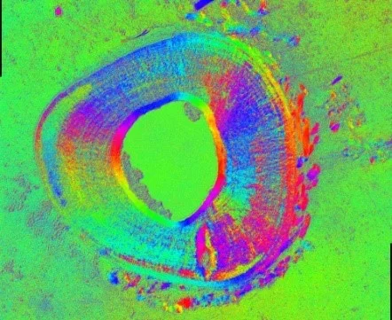 Femur cross-section