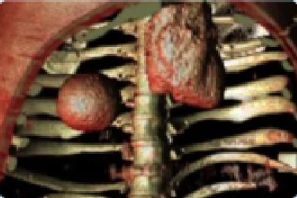 4D anthropomorphic lung phantom