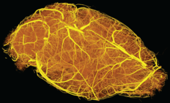 3D reconstruction of an entire adult mouse brain vasculature. 