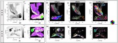 Micro- and nano-calcifications as well as collagen, elastin and myofilament have been mapped using scanning SAXS and WAXS
