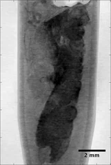 Reconstructed slice of X-ray phase contrast microtomography from a human breast biopsy tissue, suspected of being affected by tumour development.