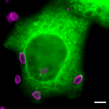 In green, a human cell infected by Toxoplasma gondii parasite (in purple). 