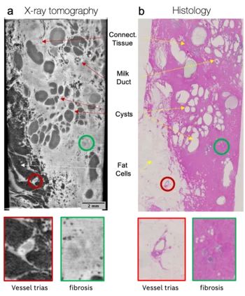 JOan Maxim improved pathology