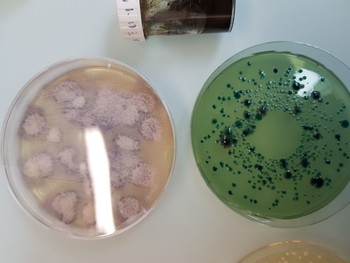 Eine Art von Schimmelpilz und Bakterien, die wir begutachten durften