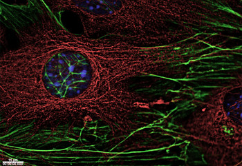 Fibres du cytosquelette (rouge et vert). À gauche, on peut voir le noyau cellulaire.