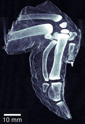 Mehr Details sind auf einem Dunkelfeld-Röntgenbild zu sehen.