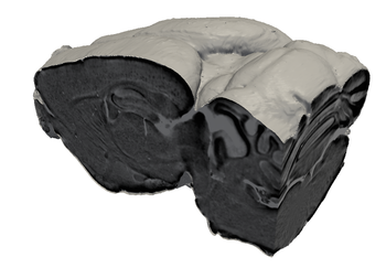 Image correspondant à un cerveau de souris reconstruit en 3D par la méthode d’imagerie de contraste de phase. Une coupe virtuelle au travers du cerveau est montrée. La technique d’imagerie permet d’observer les plaques amyloïdes sans couper physiquement le cerveau en tranches. (Image: Institut Paul Scherrer/B. Pinzer)
