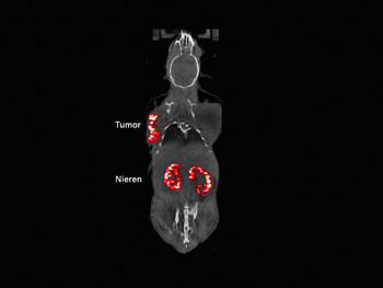 The radioactively-marked mini-gastrin PSIG-2 primarily accumulates in the tumour and kidneys. In the process, roughly as much of the radioactive drug is absorbed by the tumour as the kidneys. This ratio is still sufficient for a course of treatment, without damaging the kidneys. (Photo: Paul Scherrer Institute)