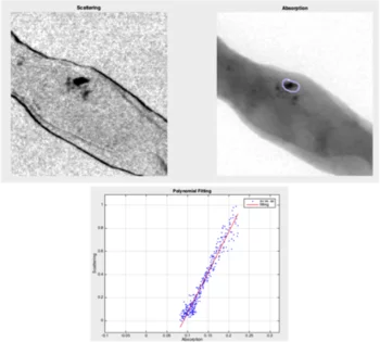 Absorption and scattering signals of microcalcification in breast biopsy tissue.