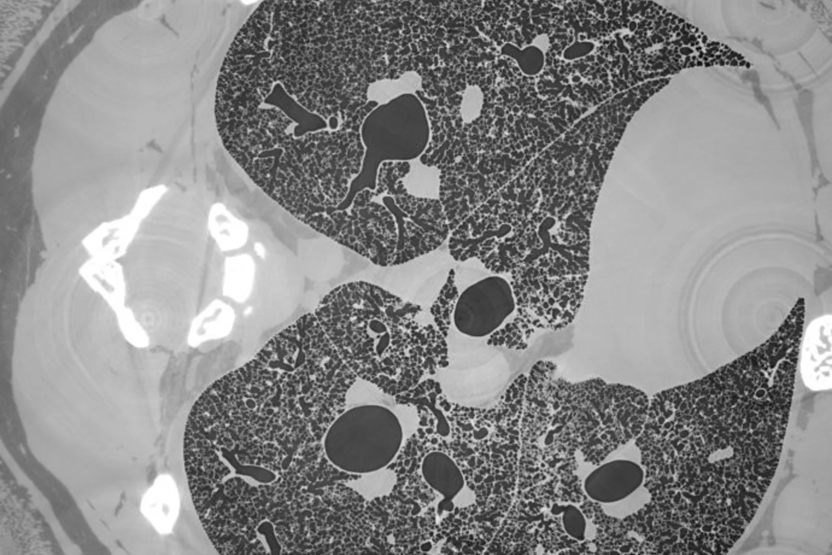 High-resolution tomographic cross-section of a fresh juvenile rat lung