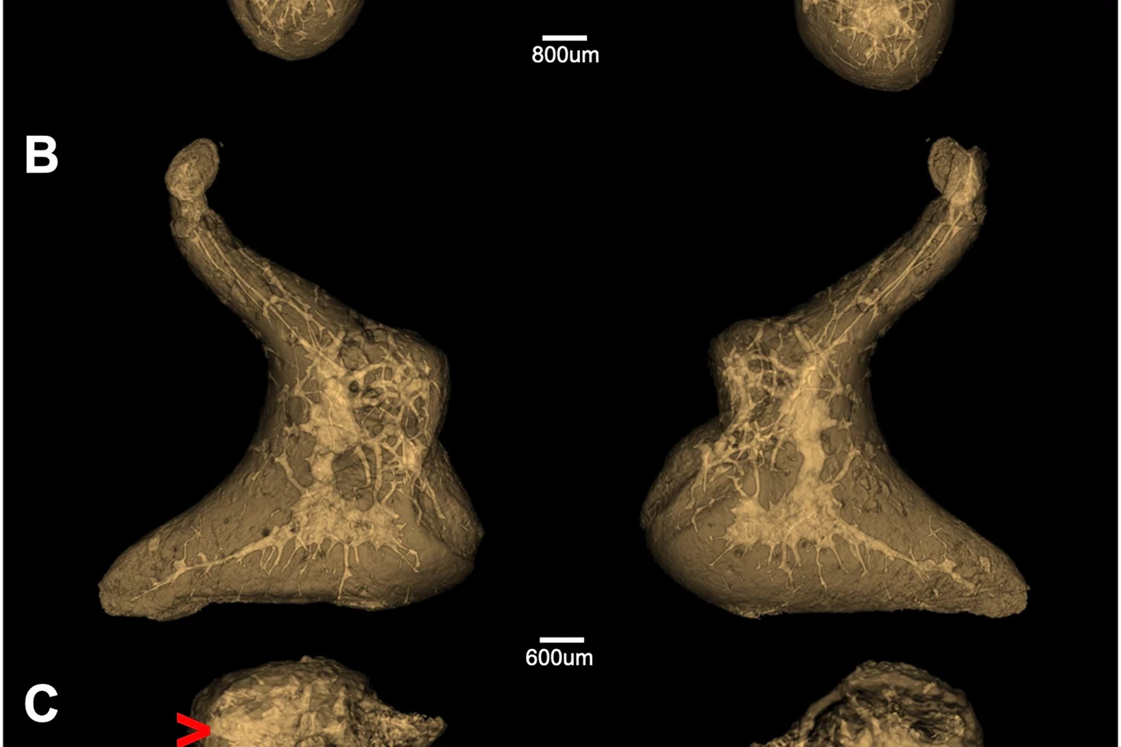 nutritional vessels of a right ossicular chain