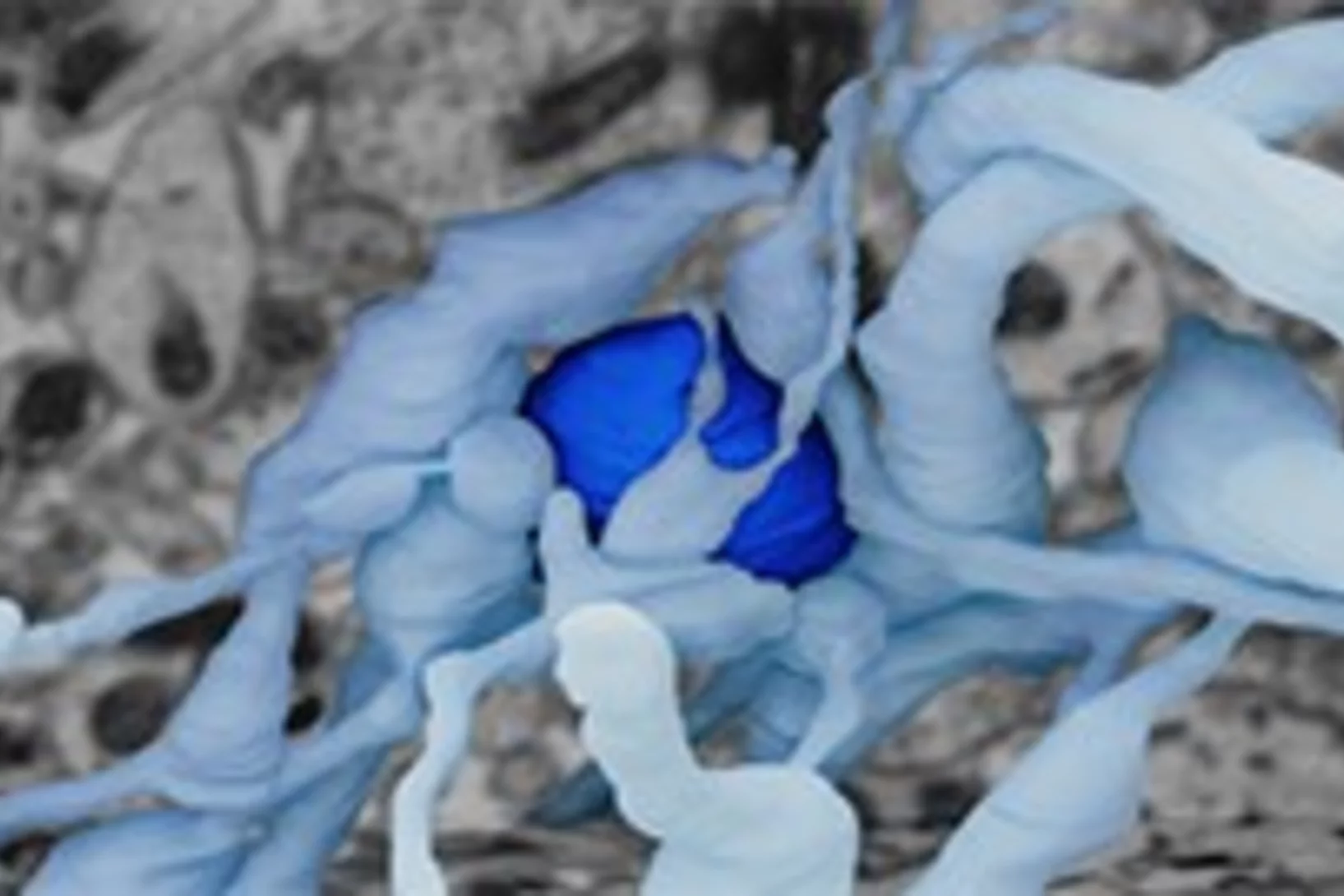 x-ray nanotomography