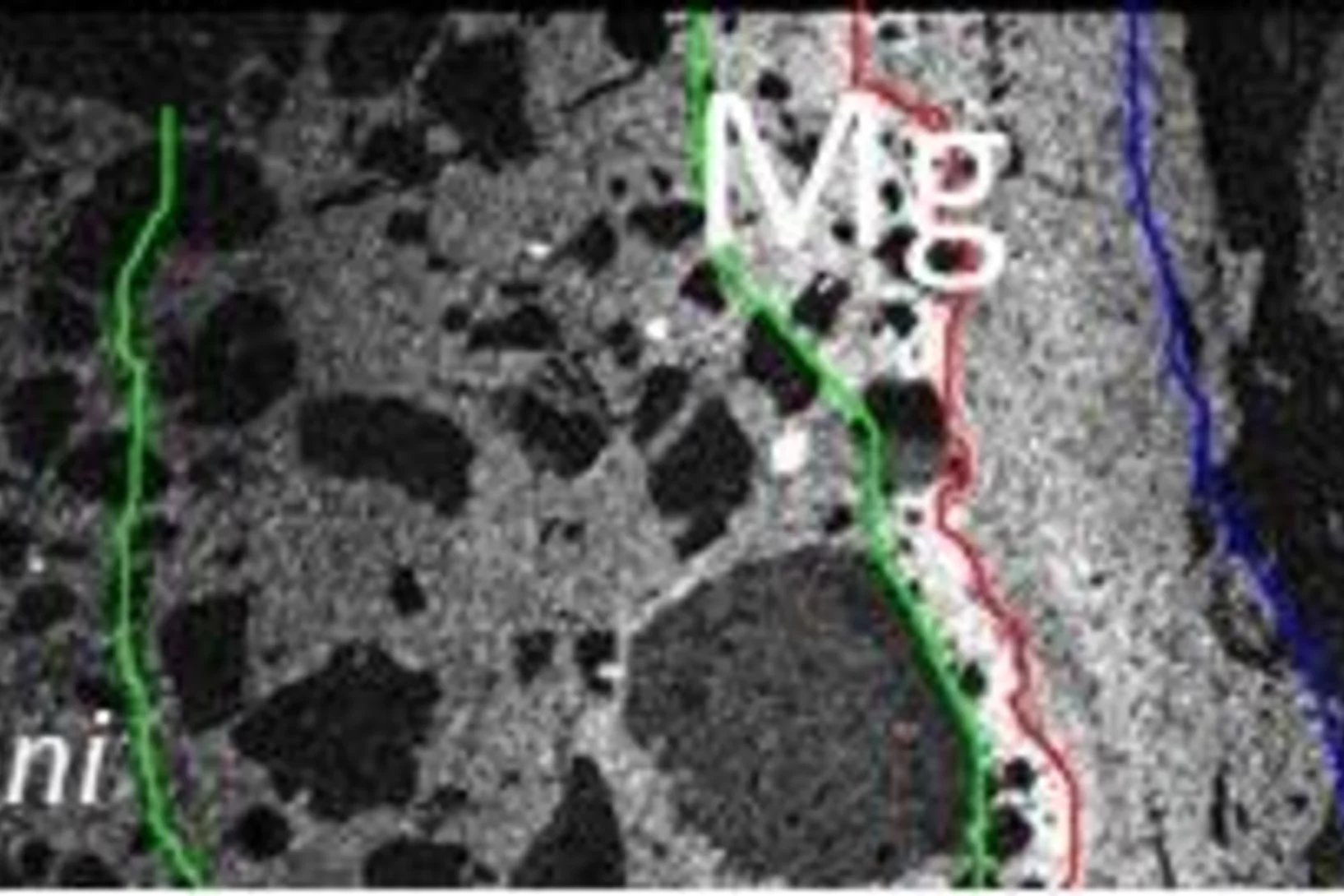 The interface between cementitious material and Opalinus Clay.