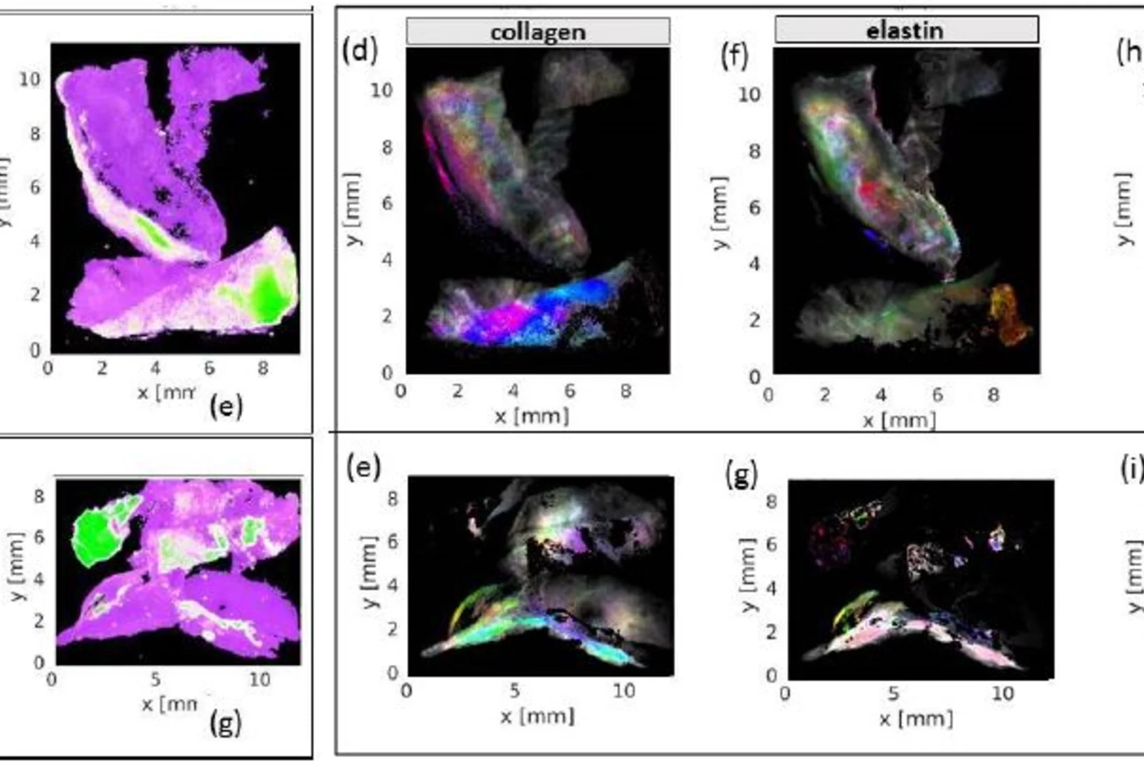 Micro- and nano-calcifications as well as collagen, elastin and myofilament have been mapped using scanning SAXS and WAXS